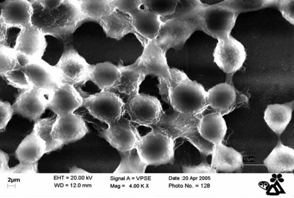 cellule di un tessuto in fase di aggregazione mette in evidenza le potenzialità del microscopio elettronico SEM anche con campioni molto delicati come le componenti organiche