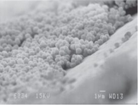 immagine ottenuta con microscopio elettronico, che mostra la crescita del biofilm