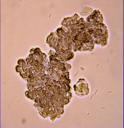 Mycobacterium Tubercolosis Morfologia delle Colonie