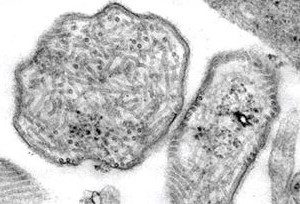 Virus della parotite osservato per mezzo di un microscopio a trasmissione elettronica