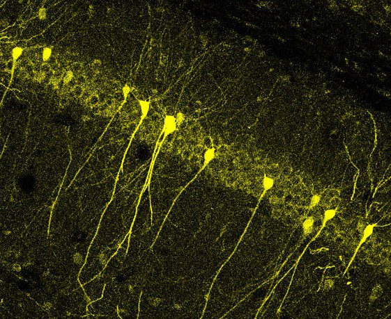 Neuroni dell'ippocampo, marcati con  YFP, yellow fluorescent protein