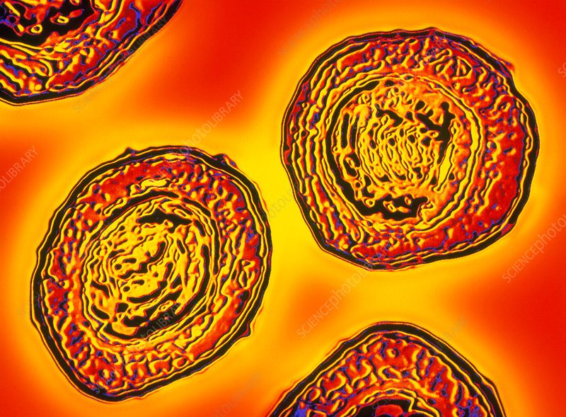 Figura 1- visualizzazione di B.pertussis al TEM 