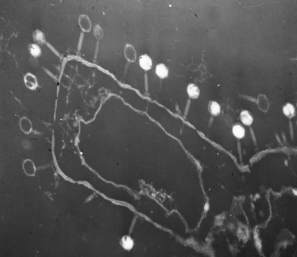 Batteriofagi osservati al microscopio elettronico adesi alla superficie batterica 