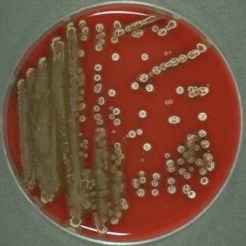Bacillus subtilis in blood agar
