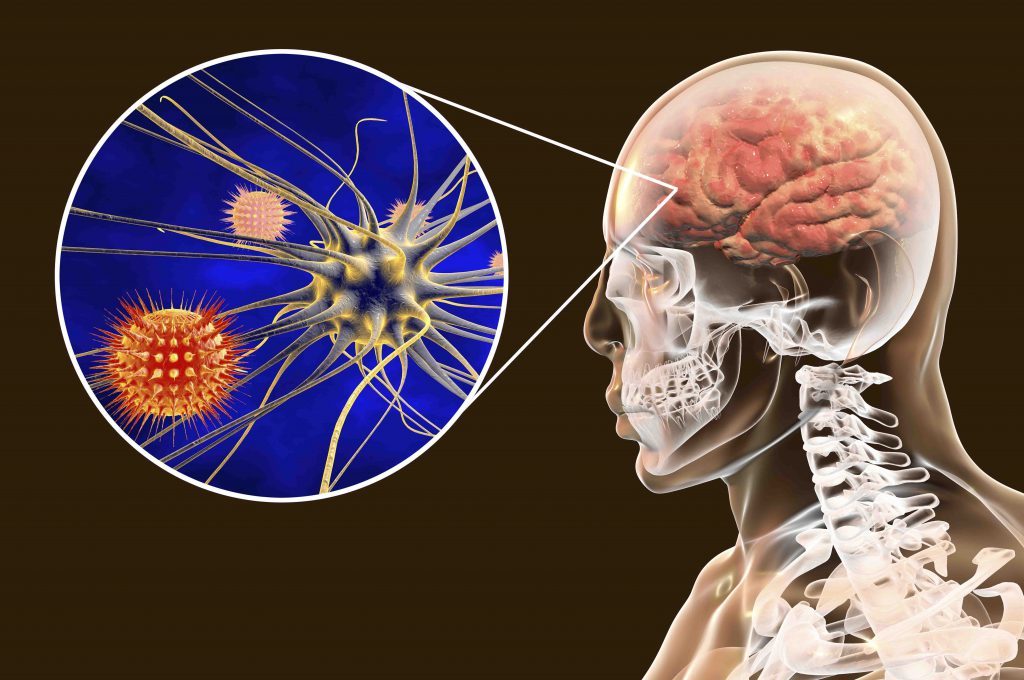 infezioni virali a danno del Sistema Nervoso