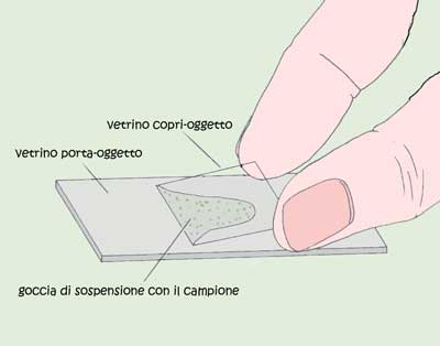 Microscopia ottica: fasi di allestimento di un campione