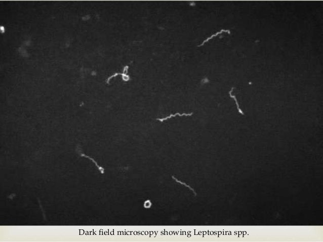 Figura 3 - Leptospire su campo oscuro microscopico