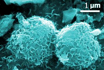 Un microrganismo metanogeno, analizzato da Carl Woese per arrivare alla scoperta degli Archaea