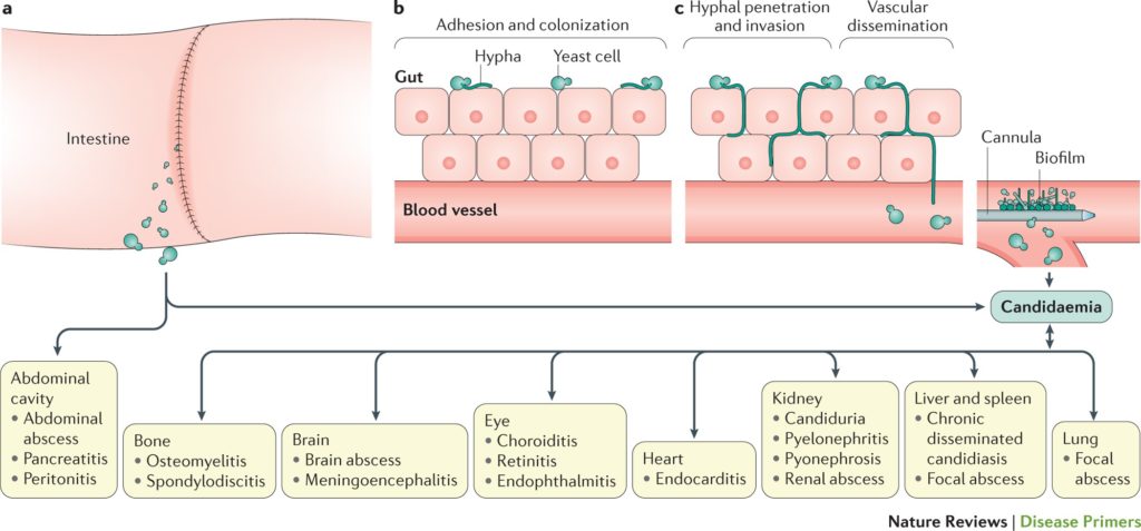 Patogenesi della candidosi invasiva.