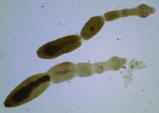 Echinococcus multilocularis