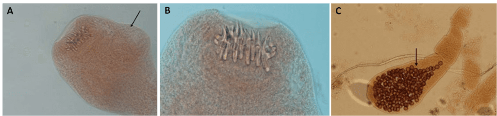 A) Microfotografia dello scolice di E. multilocularis; la freccia indica una ventosa. B) Microfotografia degli uncini dello scolice. C) Microfotografia di una proglottide gravida; la freccia mostra l’utero contenente le uova