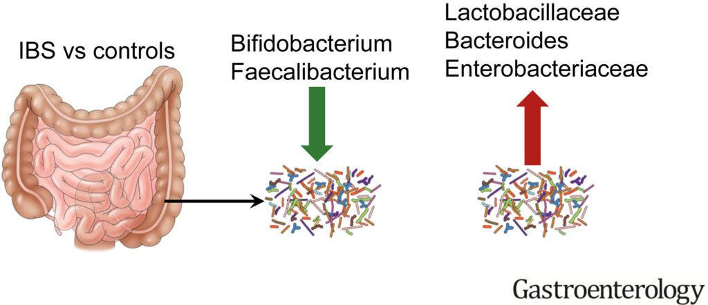 Studi sulle differenze della composizione del microbiota in soggetti sani rispetto a soggetti con IBS ha permesso di comprendere come alcune specie aumentino mentre altre subiscano una forte riduzione.