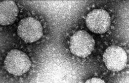 TGEV osservato mediante microscopio elettronico