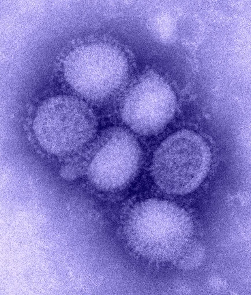 Influenza virus H1N1