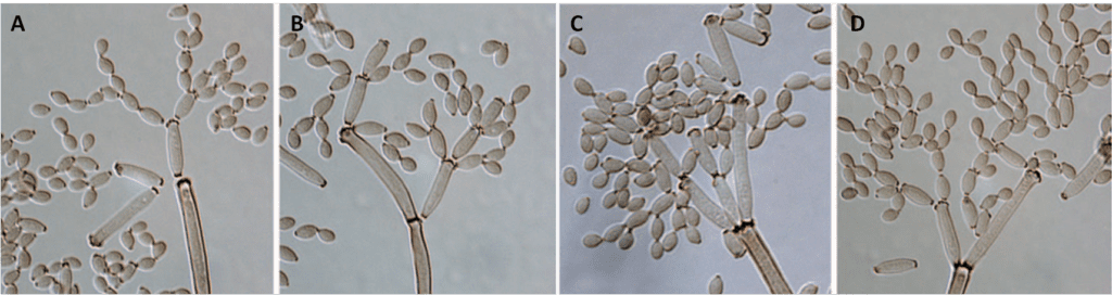 Figura 2 – Conidiofori e catene di conidi di C. cladosporioides