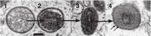 Cambiamento di forma durante la maturazione di un poxvirus. 1-2) Virione immaturo; 3) Virione maturo intracellulare; 4) Virione extracellulare rivestito, le frecce indicano le due membrane dell’envelope