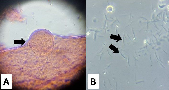 Stadi di sviluppo di Plasmodium vivax nella zanzara