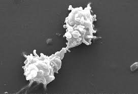 Acanthamoeba polyphaga, l'ameba ospite del Mimivirus