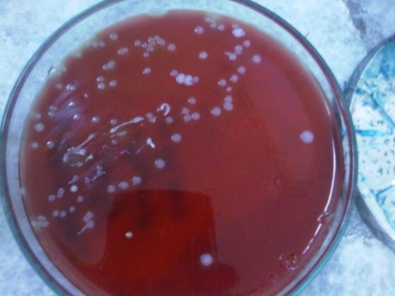 Streptococcus salivarius su agar sangue
