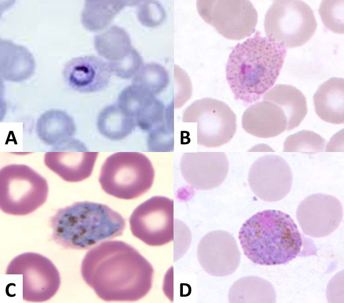 Stadi dello sviluppo eritrocitario di Plasmodium ovale