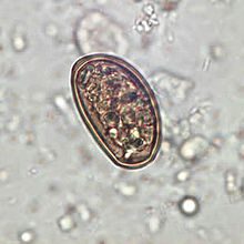 Aspetto microscopico di uova del Dicrocoelium dendriticum
