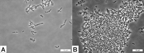 Bifidobacterium al microscopio ottico