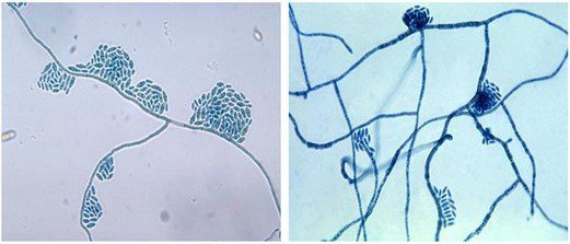 H. werneckii al microscopio [https://www.creative-biolabs.com/drug-discovery/therapeutics/hortaea-werneckii.htm]