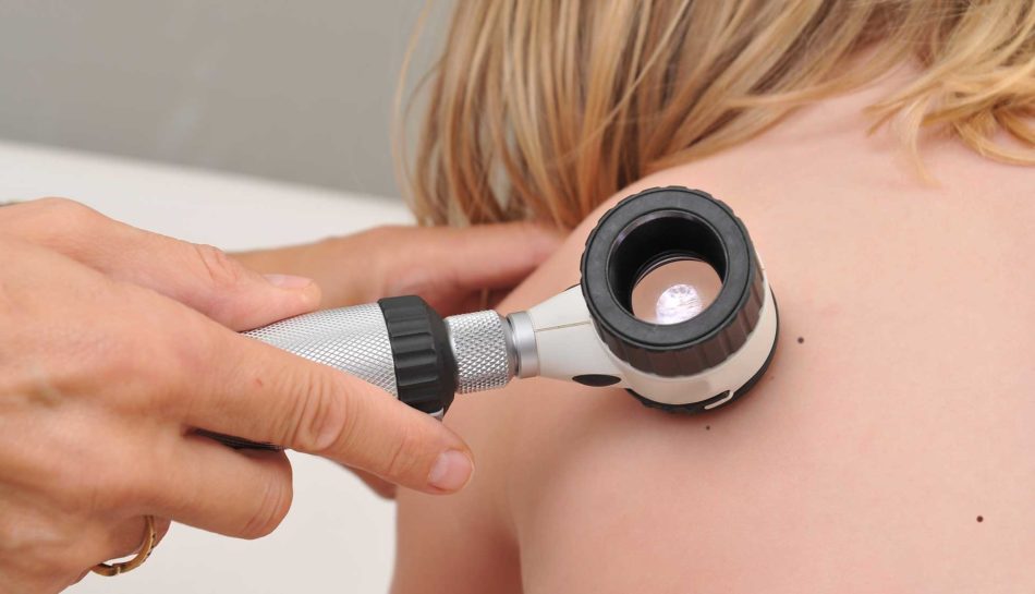 Esame delle lesioni cutanee mediante il dermatoscopio [https://www.uppa.it/medicina/malattie-e-disturbi/nei-e-melanoma/]