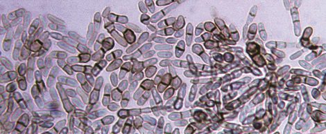 Cellule di H. werneckii; alcune appaiono scure per la presenza di melanina [https://mycology.adelaide.edu.au/descriptions/hyphomycetes/hortaea/]