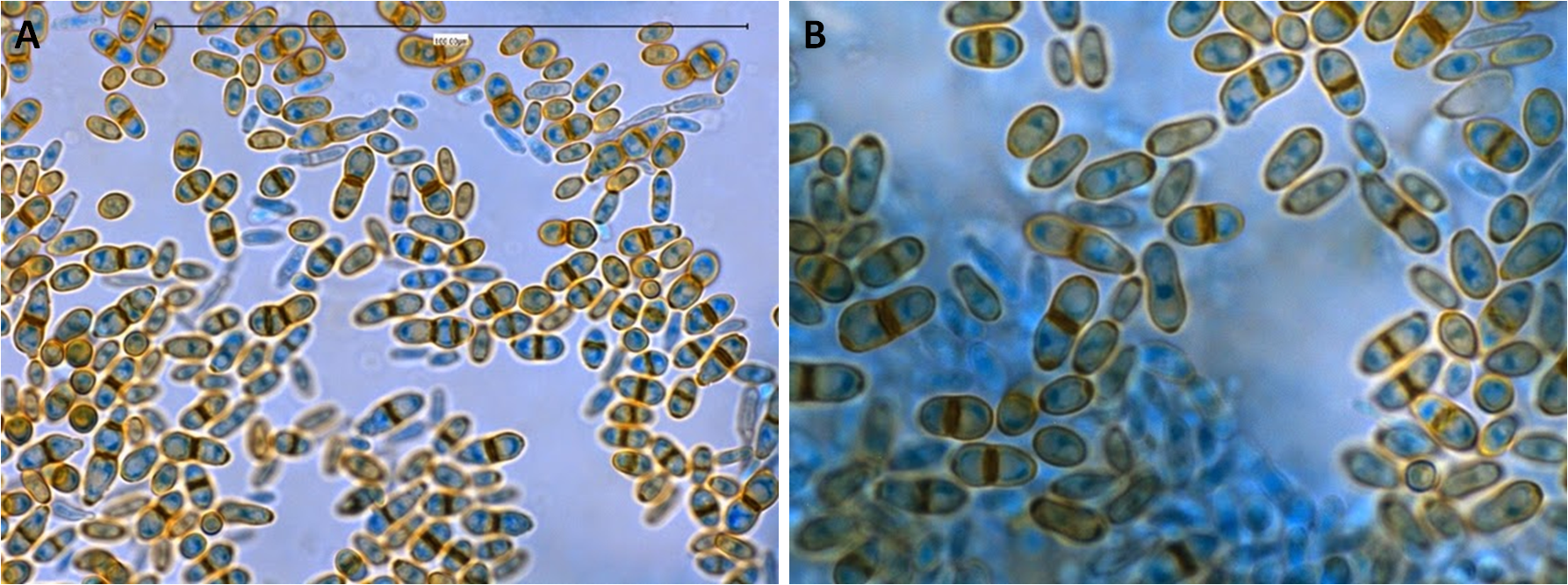 Anelloconidi di H. werneckii colorati con lattofenolo blu di cotone. L’immagine A mostra i conidi maturi aventi una pigmentazione marrone, mentre le cellule più giovani si colorano più intensamente di blu. Un’estremità degli anelloconidi di solito è più scura, e ciò indica il punto in cui il conide era precedentemente attaccato all’anellide conidiogeno. Nell’immagine B possiamo apprezzare anelloconidi bicellulari a diversi stadi della pigmentazione con un ingrandimento maggiore [http://thunderhouse4-yuri.blogspot.com/2014/03/hortaea-werneckii.html]