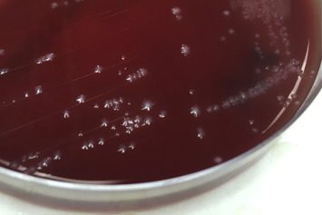 Bifidobacterium in blood agar