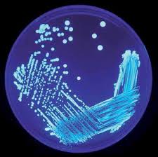 Colonie di Legionella bozemanni su Feeley Gorman Agar. Si nota la fluorescenza bianco blu, specifica di questa specie.