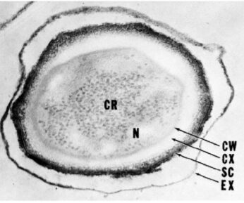 struttura dell'endospora di Bacillus anthracis