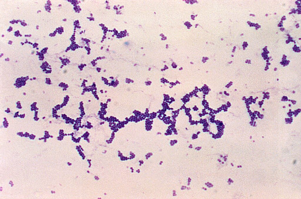 Staphylococcus aureus al microscopio ottico.