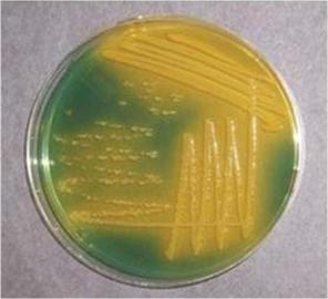 Colonie di Vibrio Cholerae su TCBS Agar