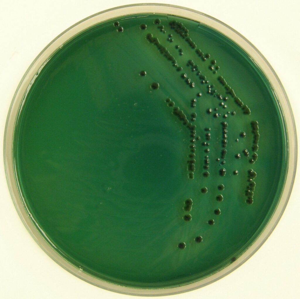 Colonie blu di V. parahaemolyticus su TCBS Agar