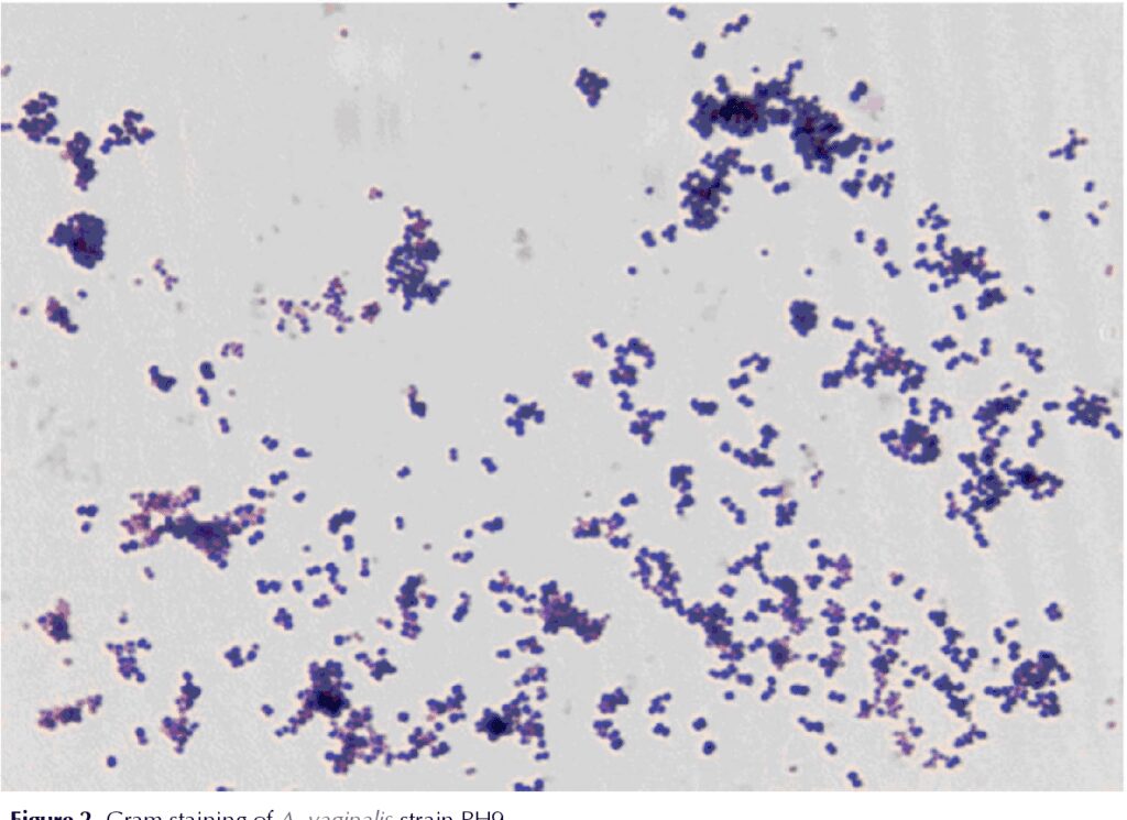 Anaerococcus vaginalis, visibile al microscopio previa colorazione di Gram,  è stato osservato come componente del microbiota del liquido seminale in pazienti con infertilità rilevando maggiore presenza del batterio nei pazienti con infertilità rispetto a quelli in un gruppo di controllo.