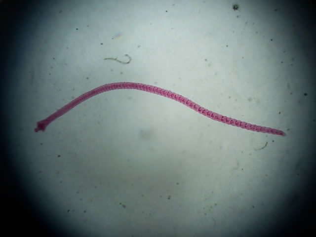 Hymenolepis nana