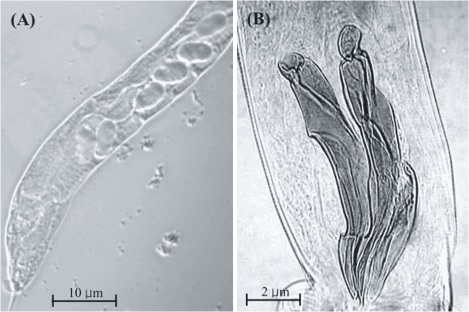 Vermi adulti di T. colubriformis provenienti da campioni umani nel Laos. A) Femmina adulta in cui si notato le uova uterine in fila. B) Spicole copulatorie del maschio adulto [Tai-Soon Yong et al., 2007]