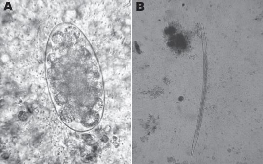 Uovo (A) e larva al terzo stadio (B) di T. colubriformis isolati dalle feci di una donna di 47 anni [“Trichostrongylus colubriformis Nematode Infections in Humans, France”, Emerging Infectious Diseases, 2011]
