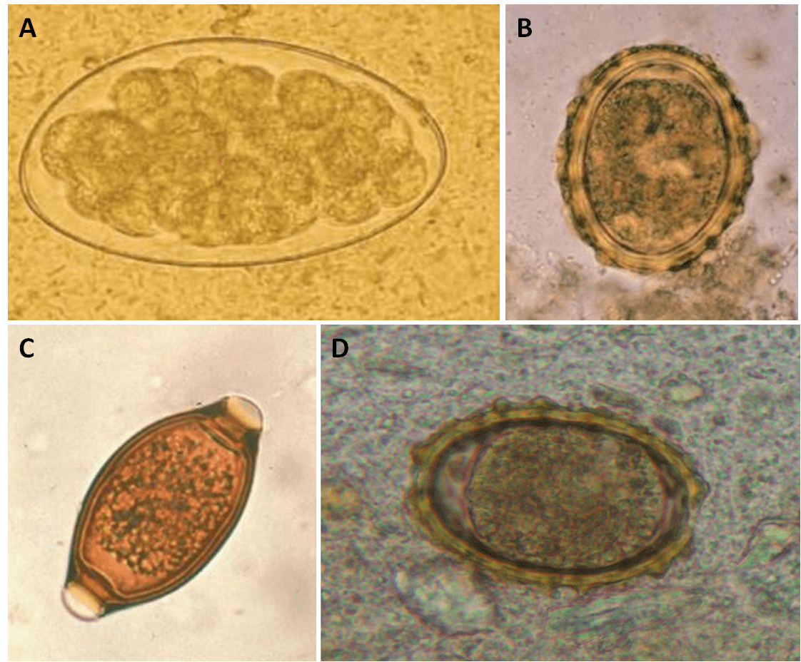 Uovo di T. colubriformis (A) a confronto con uova di Ascaris lumbricoides (B), Trichuris trichuria (C) e Ancylostoma duodenale (D) [Keyhan Ashraf et a., 2014 / https://www.researchgate.net/figure/Ancylostoma-duodenale-egg-with-larva_fig6_7226387 / https://www.researchgate.net/figure/Ascaris-lumbricoides-Trichuris-trichiura-hookworm-eggs-and-Strongyloidiasis_fig2_332164167]