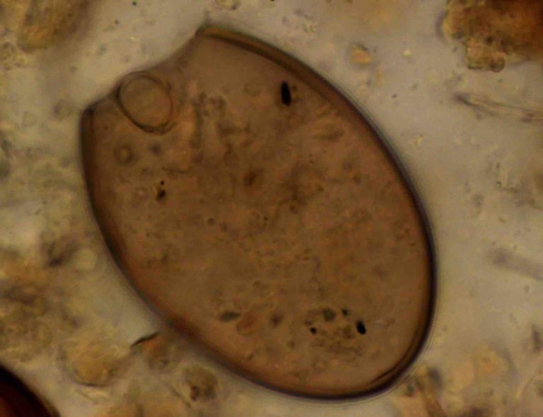 Immagine al microscopio di uova di Dibothriocephalus sp., facente parte del microbiota medievale