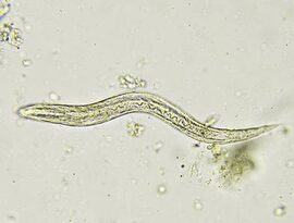 Femmina di Strongyloides stercoralis