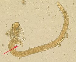 Maschio di Strongyloides stercoralis