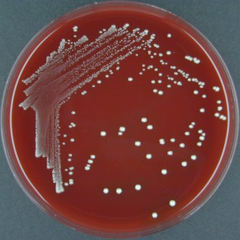  Fusobacterium su blood agar