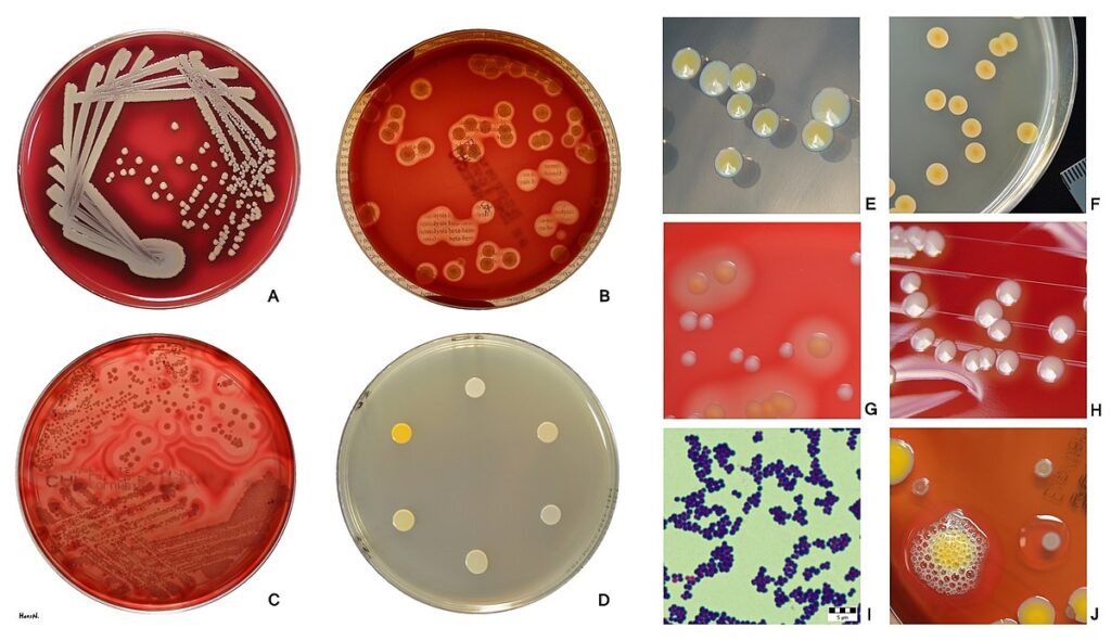 Popolaione di S. aureus su diversi terreni di coltura, produzione di pigmenti, emolisi e morfologia.