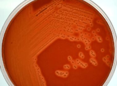 Streptococcus sanguis su Columbia blood agar