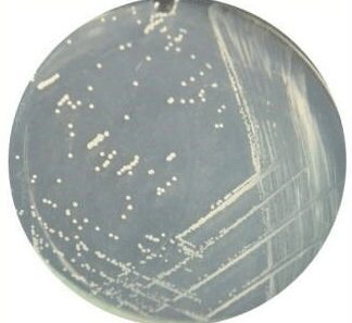 Coltura di Streptococcus sanguis