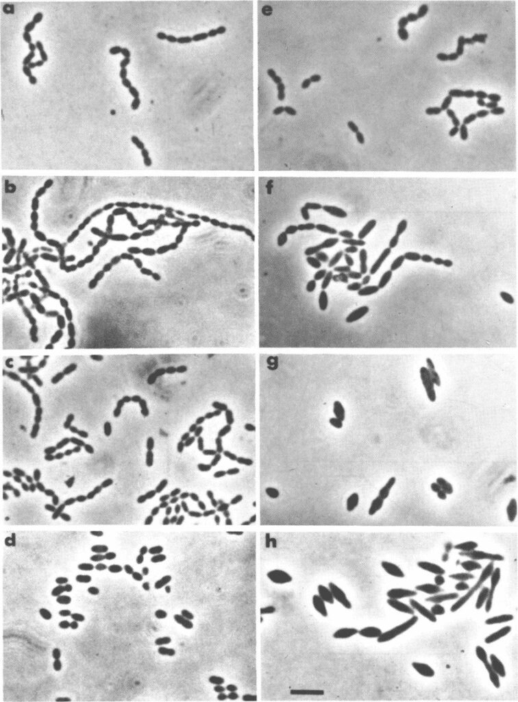 Streptococcus sanguis al microscopio ottico