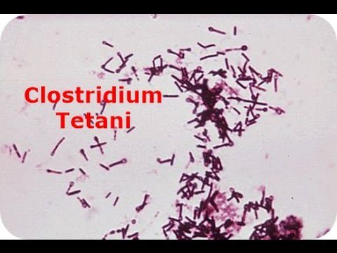 Aspetto microscopico del Clostridium tetani